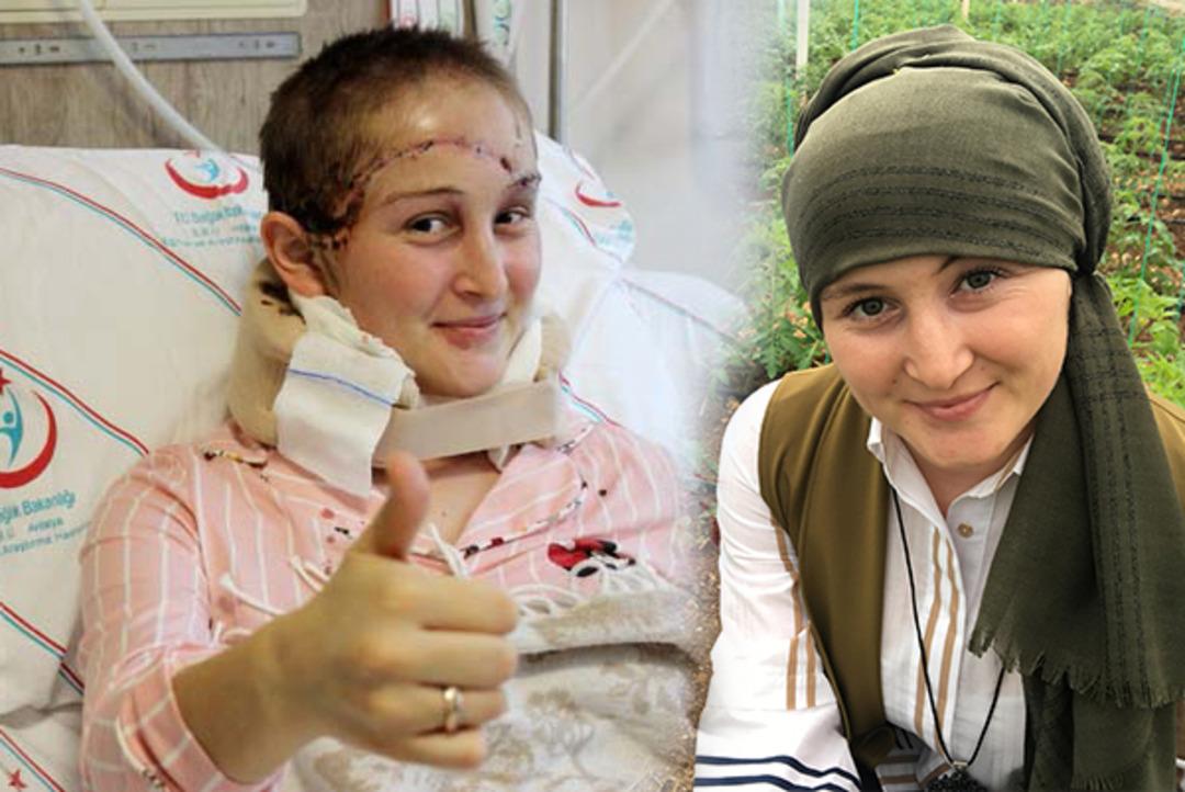 Sa&ccedil; derisi kopmuştu! Aylar sonra trakt&ouml;r kullandı