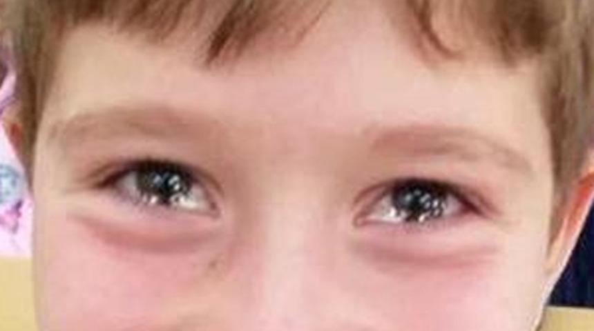 Minik Yalçın'ın gözleri tüm Türkiye'yi ağlattı!