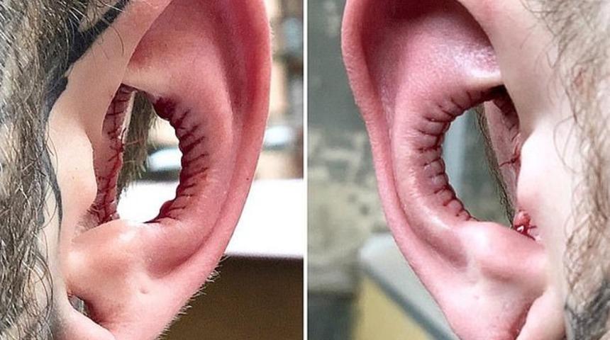 Modaya uydu! Kulağının i&ccedil;ini ameliyatla aldırdı