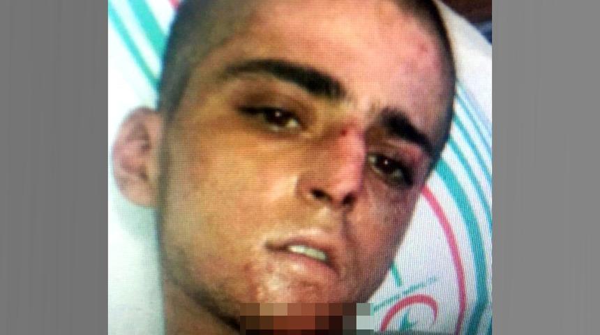 Narkozun etkisi geçerken 'YPG' deyince kim olduğu ortaya çıktı!