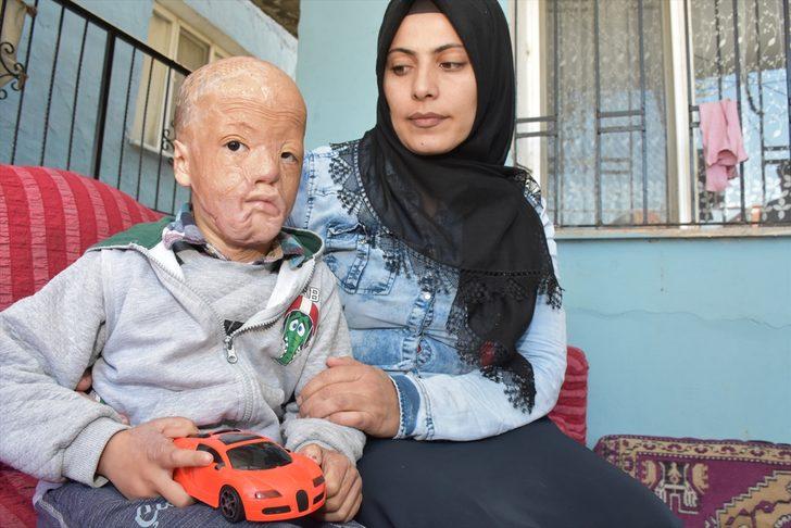 Minik Halil için  'Ateşe bir damla su dök' kampanyası başlattılar G1