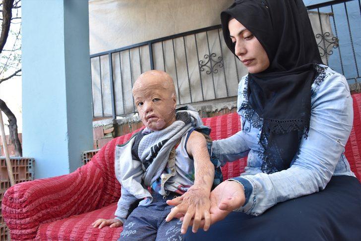 Minik Halil için  'Ateşe bir damla su dök' kampanyası başlattılar G2