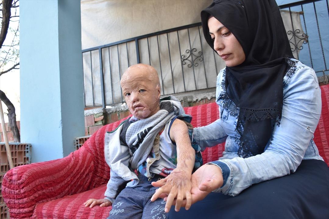 Minik Halil i&ccedil;in  'Ateşe bir damla su d&ouml;k' kampanyası başlattılar