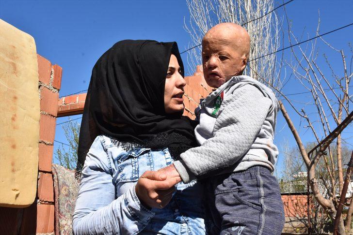 Minik Halil için  'Ateşe bir damla su dök' kampanyası başlattılar G3