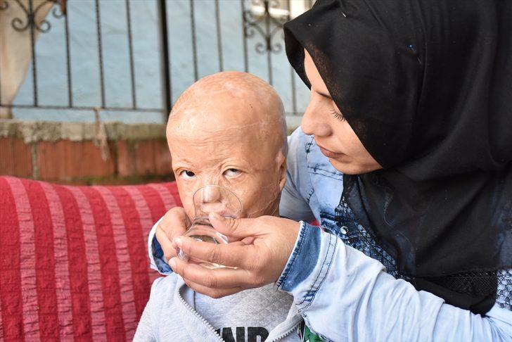 Minik Halil için  'Ateşe bir damla su dök' kampanyası başlattılar G4