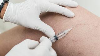 Lazerle varis tedavisi nasıl yapılır? Endovenöz Lazer nedir, nasıl yapılır?