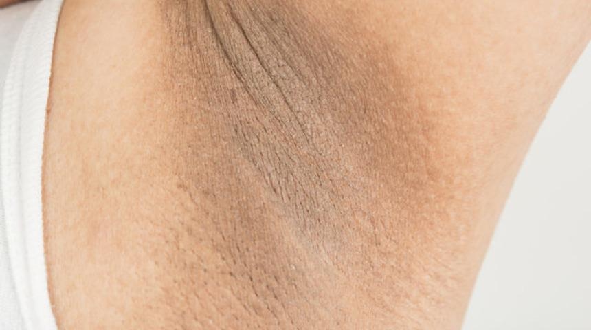 Koltuk altı diz ve dirsek kararmalarını ge&ccedil;iren 5 y&ouml;ntem