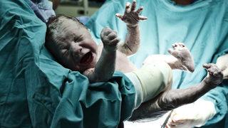 Sezaryen mi normal doğum mu? 