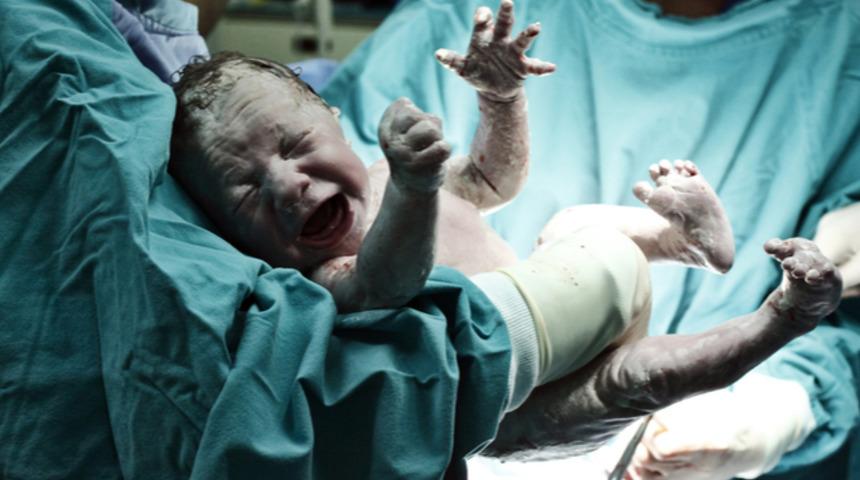 Sezaryen mi normal doğum mu? 