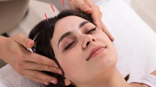 Gebelikte akupunktur uygulanır mı? Gebelikte akupunkturun zararı var mıdır?