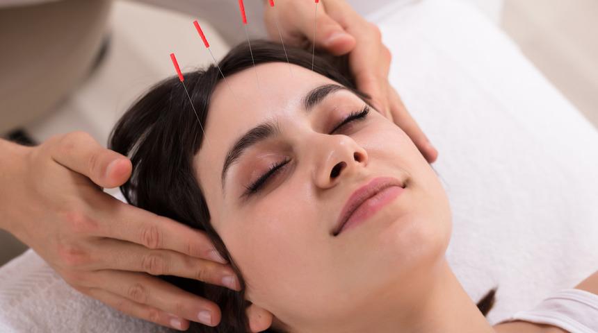 Gebelikte akupunktur uygulanır mı? Gebelikte akupunkturun zararı var mıdır?