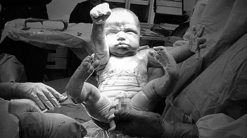 İnanılmaz doğum anı! Doğar doğmaz 'kahraman' oldu