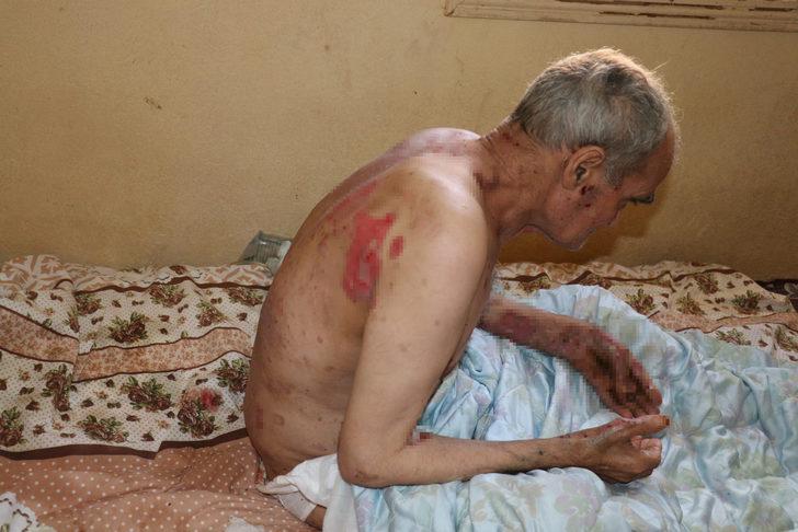 60 yaşında kabusu yaşıyor! G1