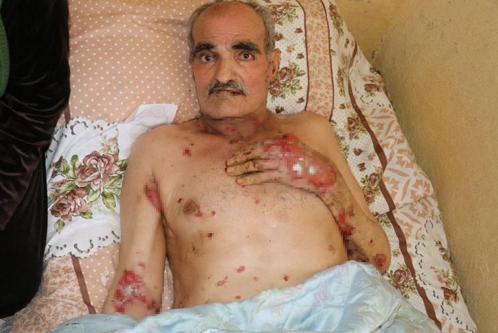 60 yaşında kabusu yaşıyor! G3