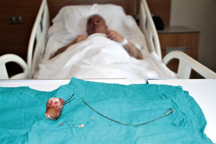 Unutkanlığın böylesi! Gerçek röntgende ortaya çıktı G1