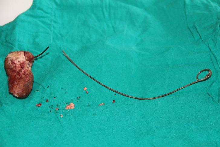 Unutkanlığın böylesi! Gerçek röntgende ortaya çıktı G2