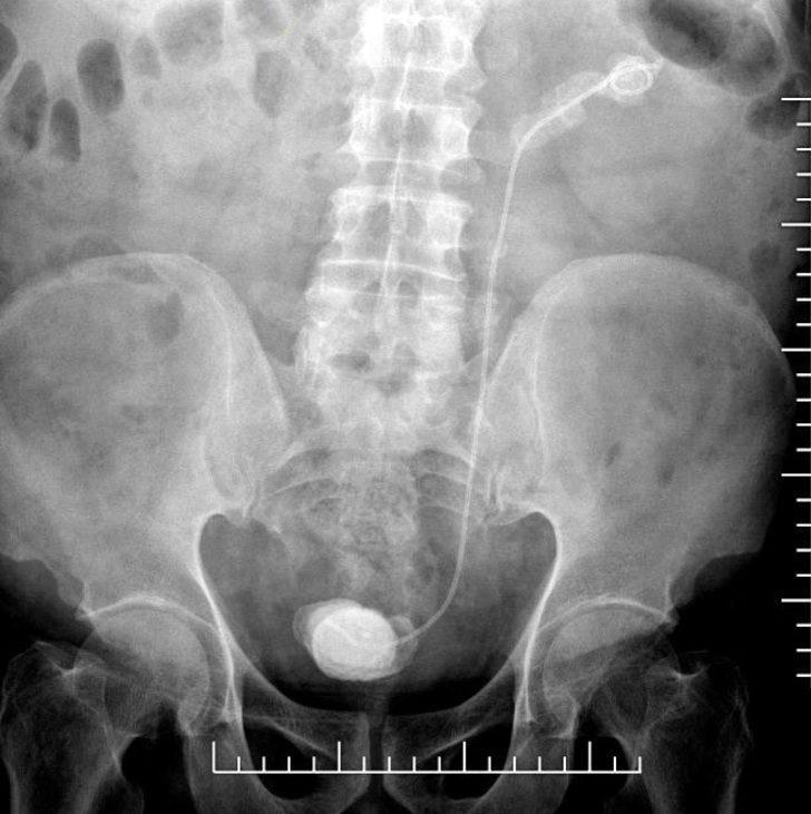 Unutkanlığın böylesi! Gerçek röntgende ortaya çıktı G3