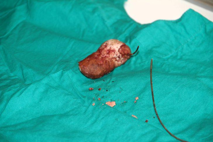 Unutkanlığın böylesi! Gerçek röntgende ortaya çıktı G4