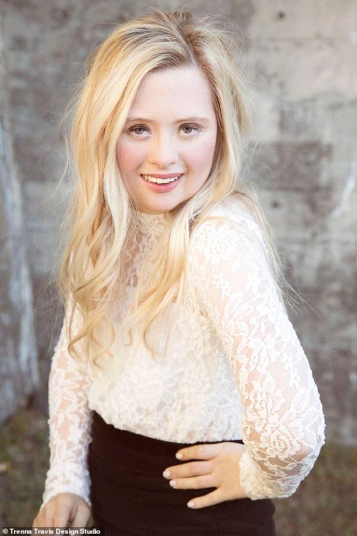 Asla normal bir hayatı olmayacağını söylediler, manken oldu G2