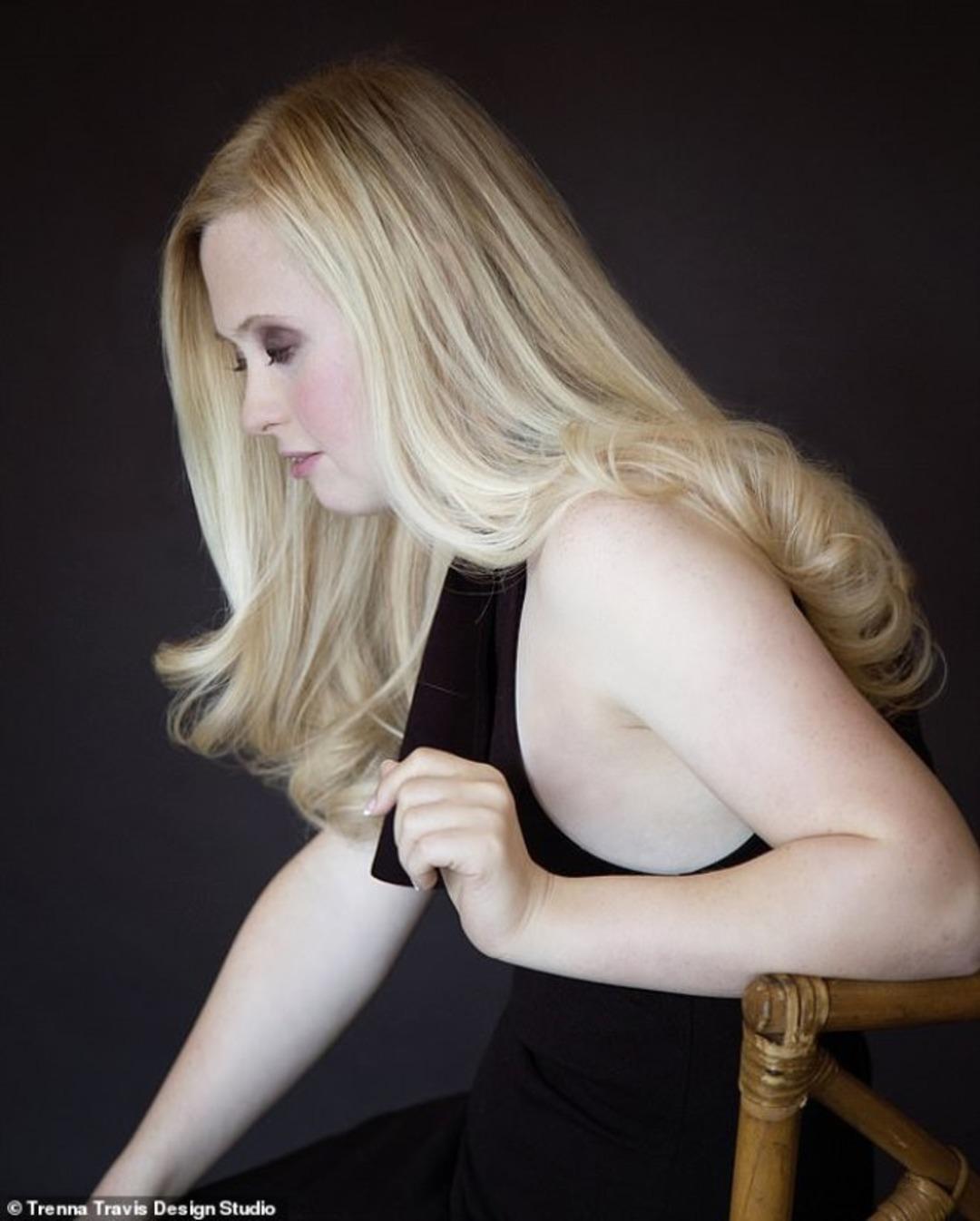 Asla normal bir hayatı olmayacağını s&ouml;ylediler, manken oldu