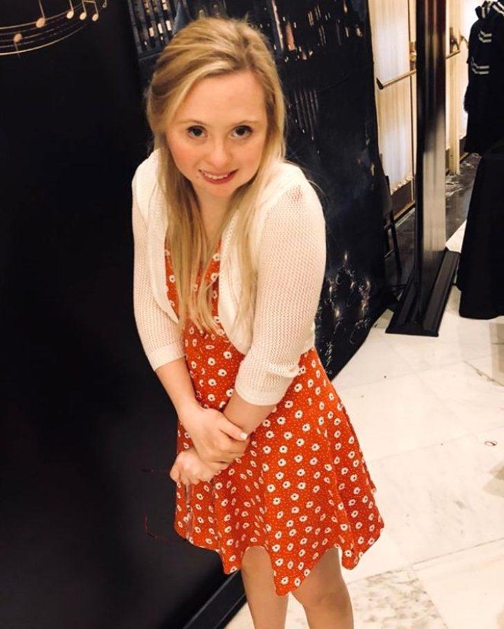 Asla normal bir hayatı olmayacağını söylediler, manken oldu G5