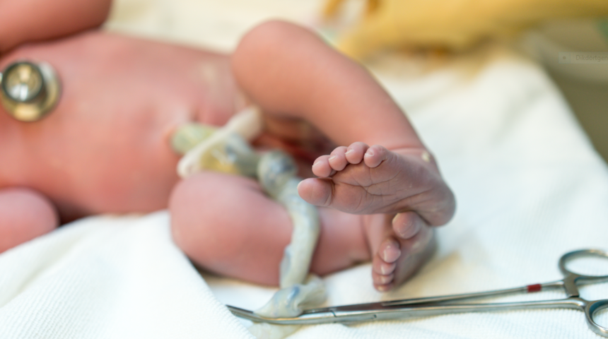 G&ouml;bek kordonu neden ge&ccedil; kesilmelidir? Kordon kesilmesi i&ccedil;in en doğru zaman nedir?