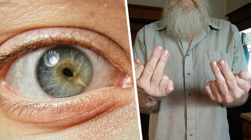 Farklılıklarımız hiç bu kadar güzel olmamıştı! İşte genetiği benzersiz kılan 15 kişi