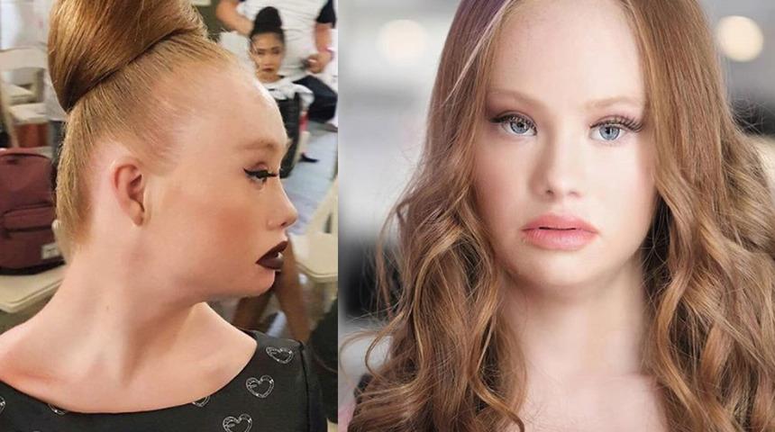 Down Sendromlu model Victoria's Secret modeli olmak, farkındalık yaratmak istiyor