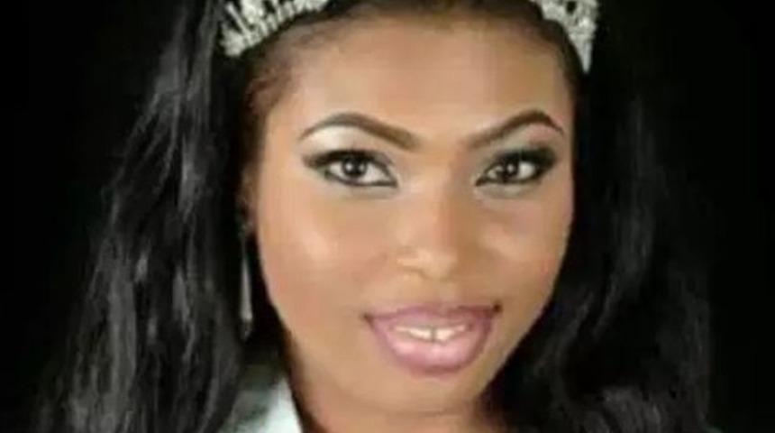 G&uuml;zellik krali&ccedil;esi kal&ccedil;a estetiğinden &ouml;ld&uuml;!