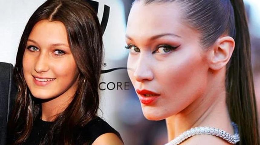 Hollywood yanağı yaptıran ünlülerin inanılmaz değişimi!