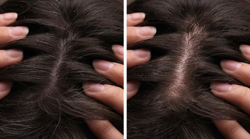 Beyaz saçları boyamadan eski rengine döndürmek için yapmanız gerekenler