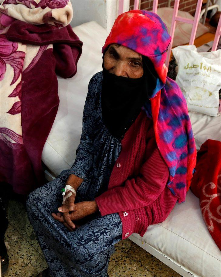 Korkunç kareler! Kolera salgını en az 190 can aldı G2