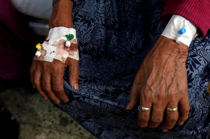 Korkunç kareler! Kolera salgını en az 190 can aldı G3