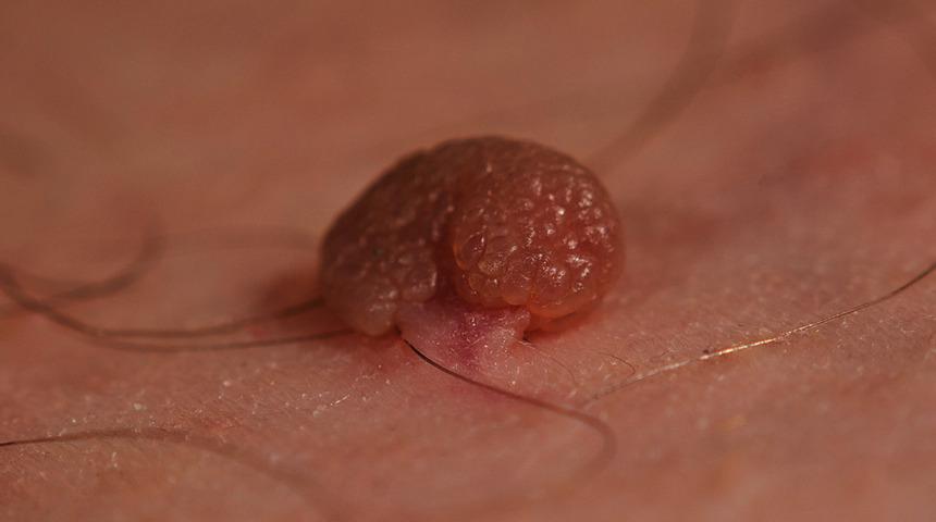 Estetik cerrahi hakkında bilinen yanlışlar 