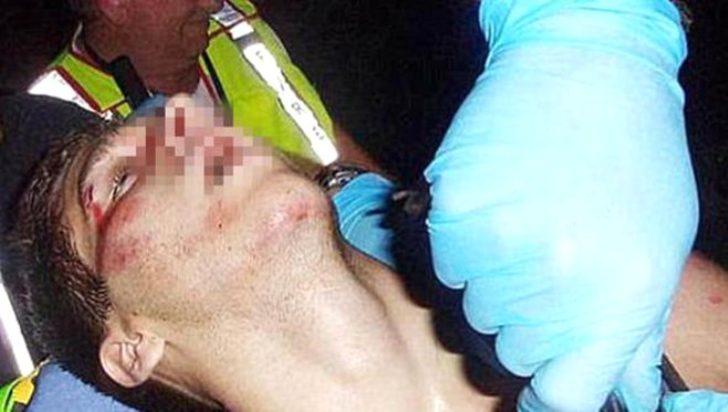 Kurbanlarını diri diri yedi! Hannibal lakaplı canini raporu kan dondurdu G1