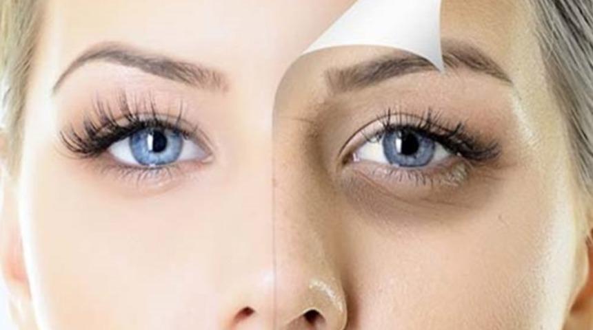 Bu zamana kadar neden denemedim dedirtecek g&ouml;z altı morlukları i&ccedil;in 3 doğal k&uuml;r