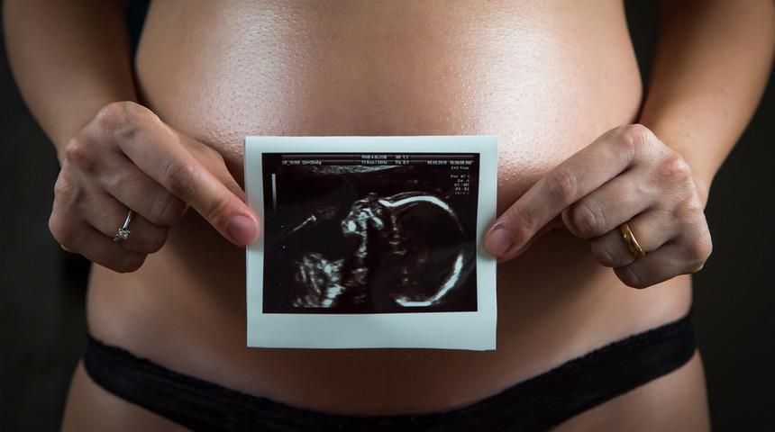 Yeni akım! Bebeklerinin cinsiyetini öğrenmek için 'kafatası teorisi' kullanıyorlar