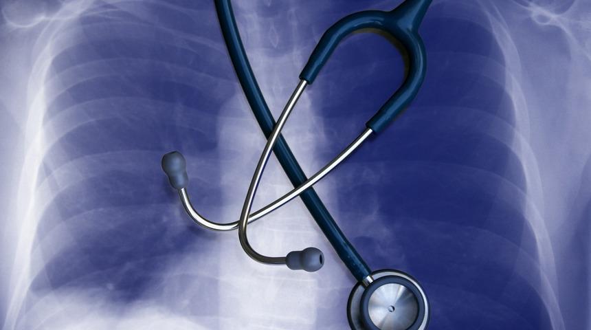 Akciğer kanseri belirtileri nelerdir? Akciğer kanseri tanısı nasıl konulur? Akciğer kanseri tedavisi nasıl olur? Erken tanı ile akciğer kanseri tedavi edilebilir