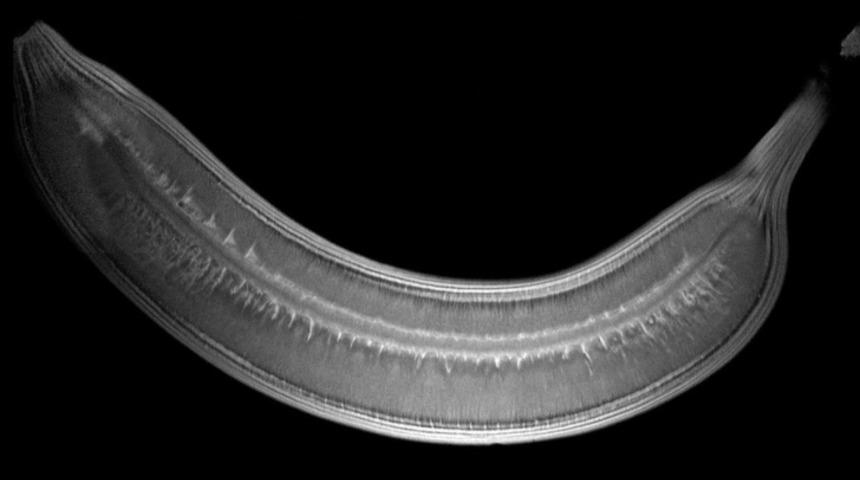 Sebze ve Meyvelerin Muhteşem MRI Görüntüleri