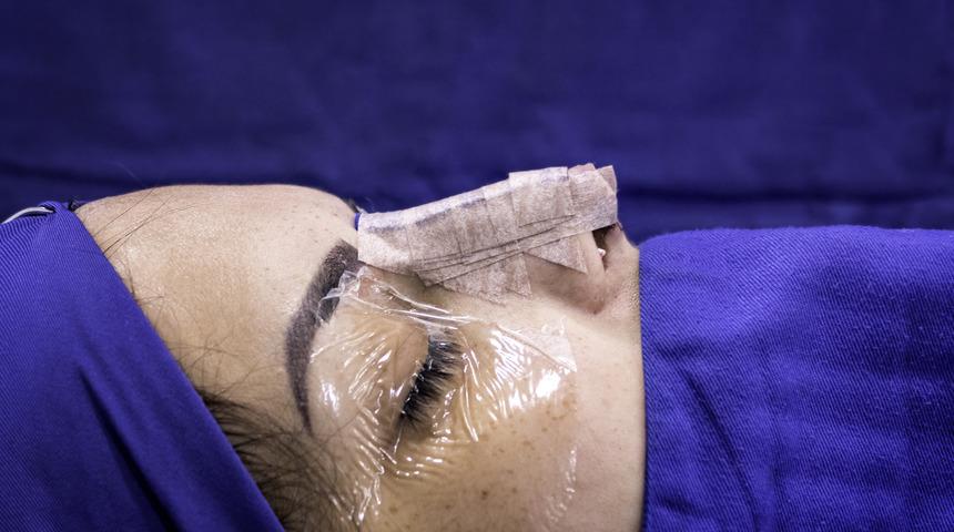 Burun ameliyatı olmadan &ouml;nce kendinize bu 5 soruyu sorun!