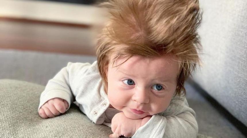 4 aylık Boston bebek sosyal medya kralı olma yolunda... 