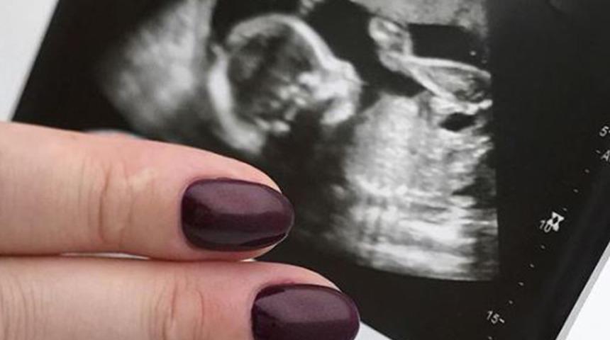 Yeni ultrason tırnak trendi!