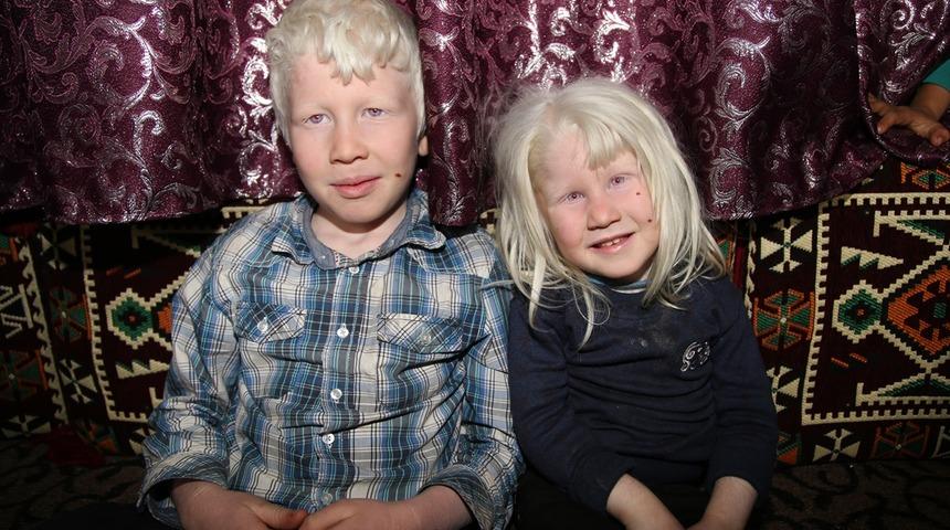 'Beyaz melekler' güneş kentinde güneşe hasret yaşıyor