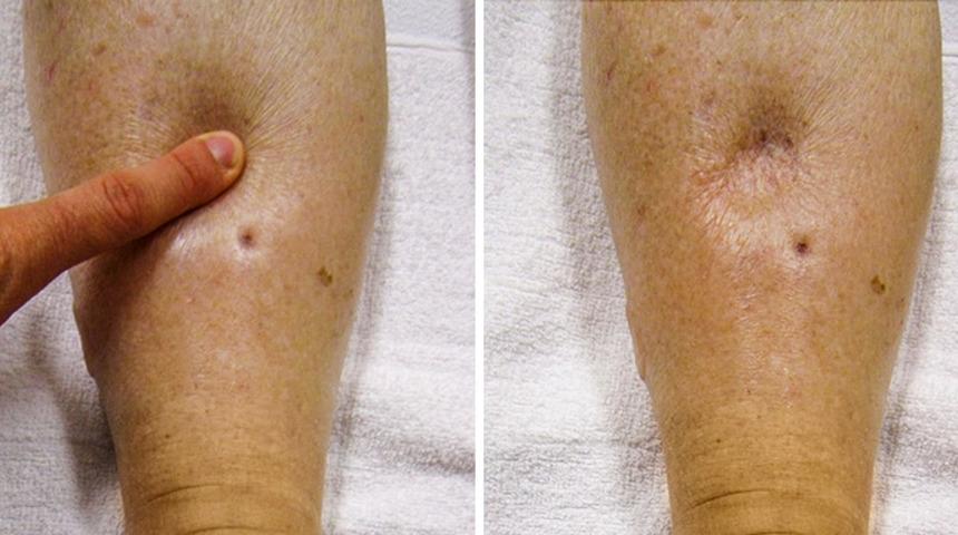  5 adımda ödemden nasıl kurtulunur?