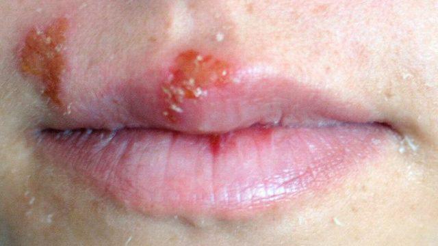 Uçuğa el sürmeyin