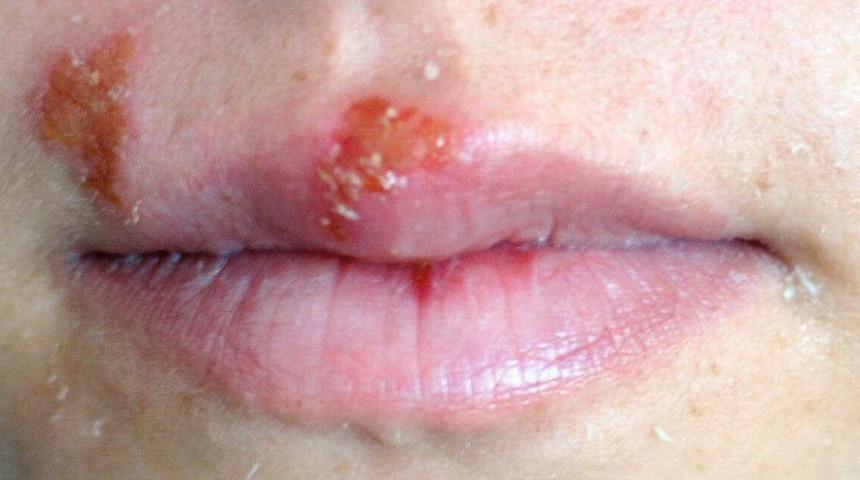 U&ccedil;uğa el s&uuml;rmeyin