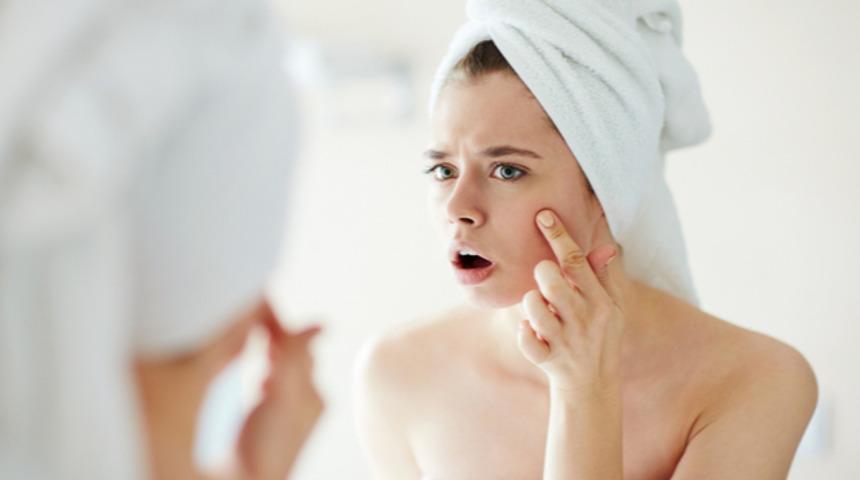 Aknelerle nasıl baş edebilirim?