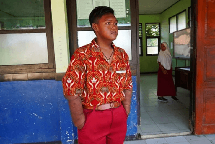  Dünyanın en şişman çocuğuydu! İşte son hali G3