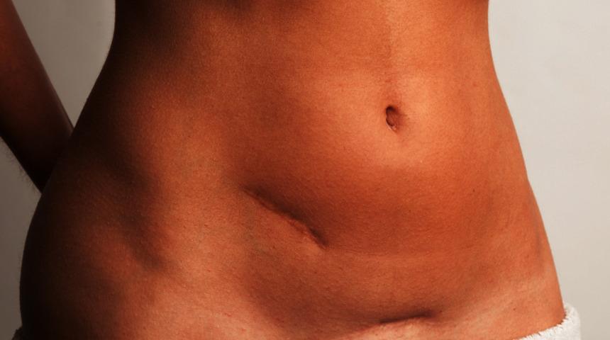 Yara izlerinin yok edilmesi mümkün değil! 