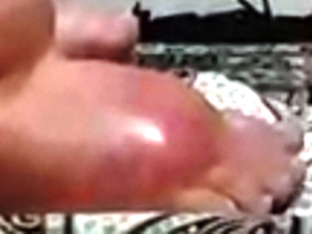 Zayıflamak isterken &ouml;l&uuml;mden d&ouml;nd&uuml;!